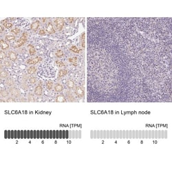 SLC6A18 Antibody, Novus Biologicals 0.1 mL | Buy Online | Novus Biologicals | Fisher Scientific